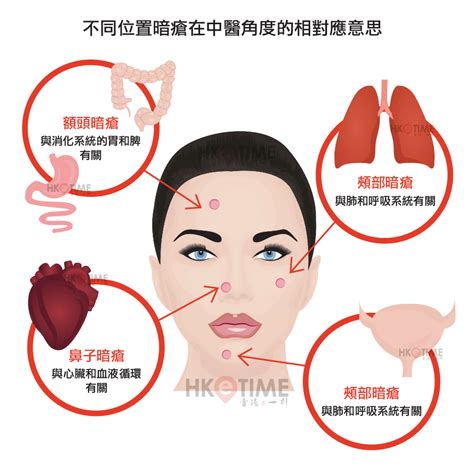 上唇 暗瘡|【暗瘡位置】暗瘡位置12個對應不同身體問題+中醫暗。